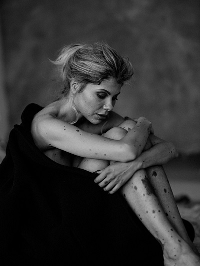 Woman with her arms around her knees